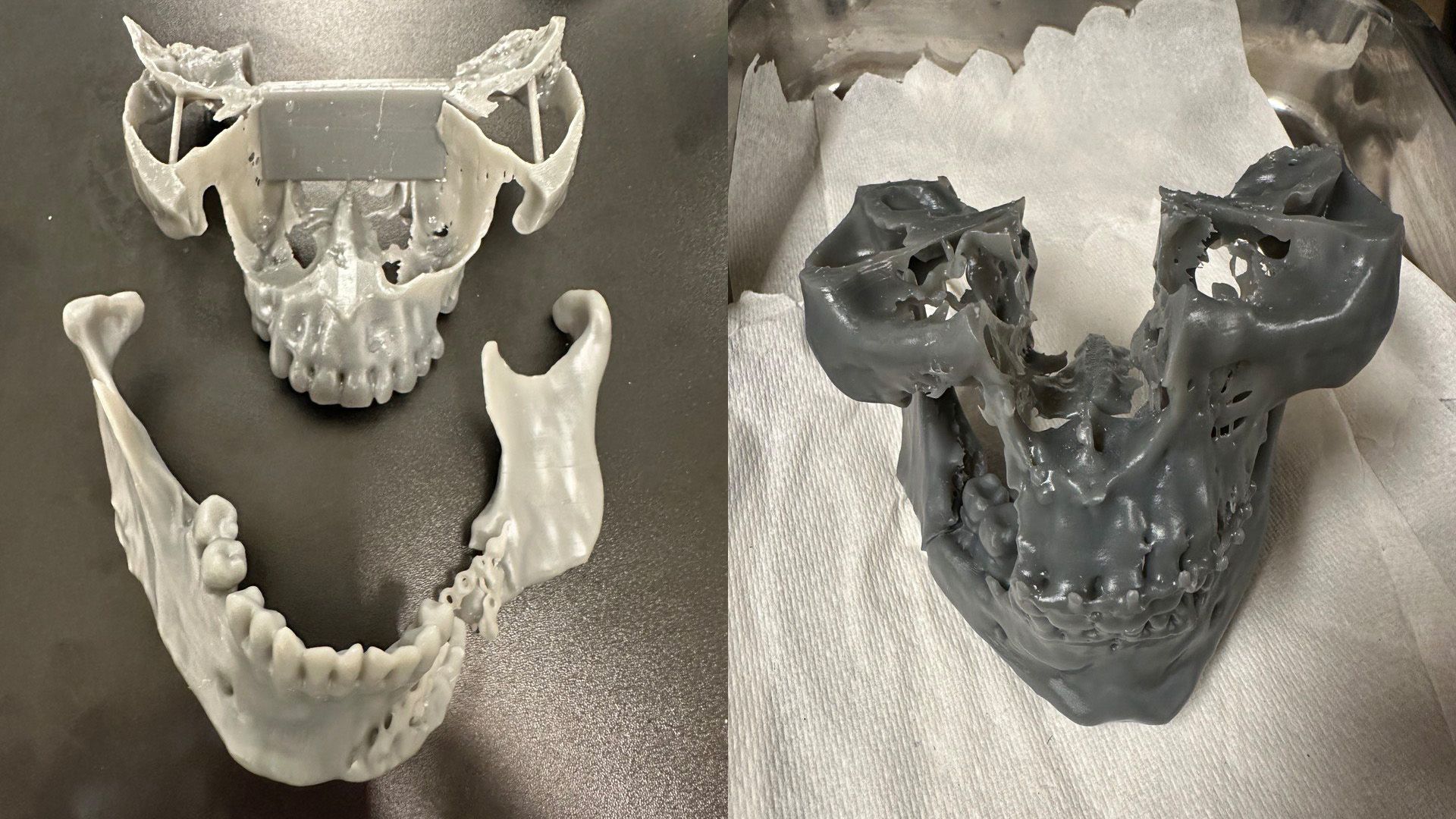 У 2024 році «Алло» спрямувала 6 млн грн на медичний 3D-друк для військових. Упродовж пів року компанія фінансувала роботу медичної 3D-лабораторії в Superhumans Center: щомісяця вона передавала по 1 млн грн на друк виробів для протезування та реабілітації пацієнтів із важкими травмами.